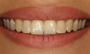 Smile Gallery