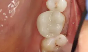 Smile Gallery