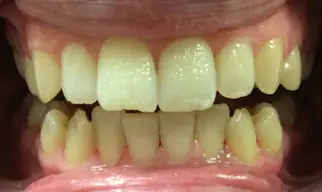 Smile Gallery