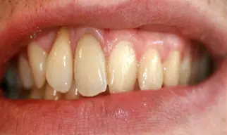 Smile Gallery