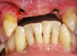 Smile Gallery